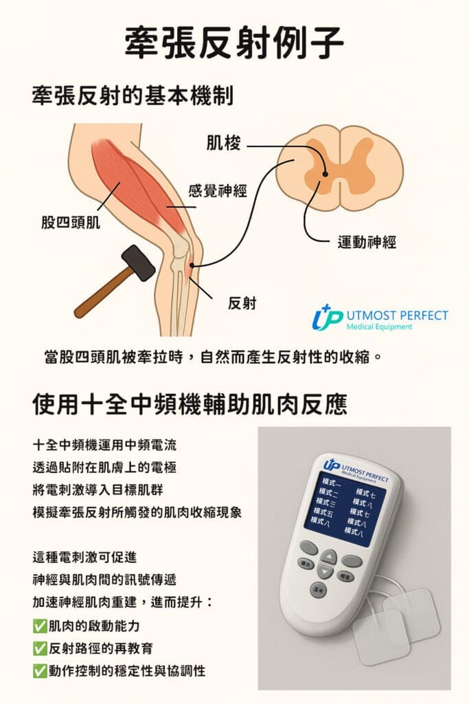 牽張反射肌肉原理與中頻機作用 - UTMOST 十全氧氣機|氧氣機推薦 牽張反射肌肉原理與中頻機作用